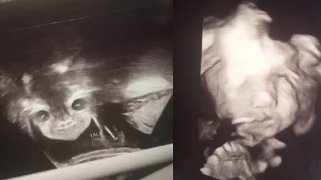 Mujer se hace ultrasonido y dice que su bebé se parece al diablo