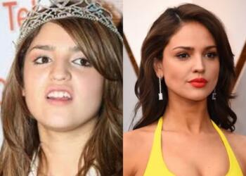 VIDEO: ‘Mi cara adelgazó’ Eiza González enfrenta a cirujano y niega haberse hecho cirugía