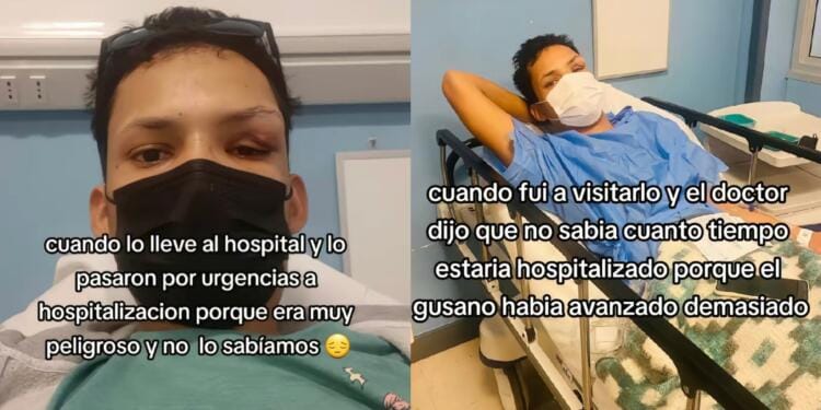 VIDEO: Joven come carne de cerdo y termina con un gusano en el ojo; el parásito quería llegar a su cerebro