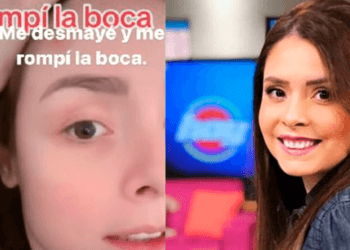 VIDEO: Maryfer Centeno sufre accidente que casi la deja sin dientes