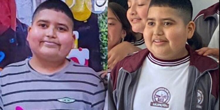 Reportan recaída en la salud de José Armando, el muchacho que decidió abandonar su tratamiento contra la leucemia