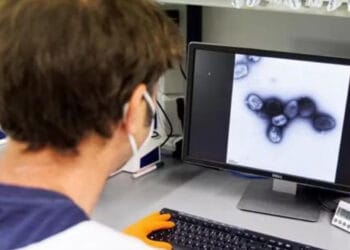 México registra 49 casos de viruela del mono en estos estados