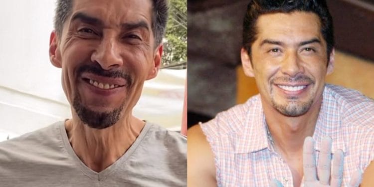 ¿Qué le pasó a Charly López? Su apariencia genera reacciones en internet