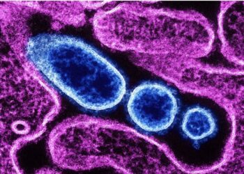 La OMS advierte de un nuevo virus en la India: qué es el Virus Nipah y cómo se transmite