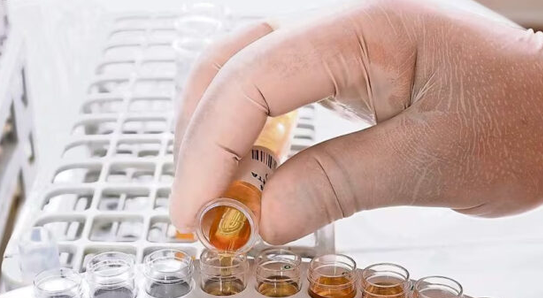 Diputado propone hacer obligatorios los exámenes antidoping para servidores públicos