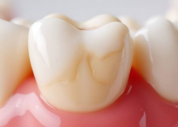 Científicos crean una pasta dental que podría ayudar a regenerar el esmalte de los dientes