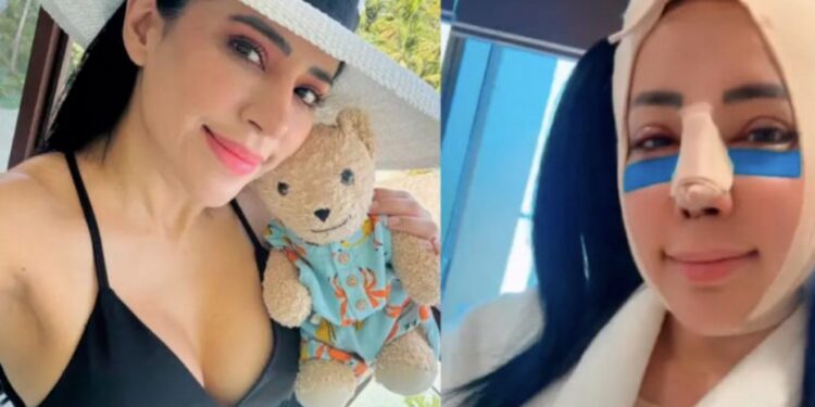 VIDEO: Sandra Cuevas reaparece tras cirugía plástica y sorprende con su nuevo rostro