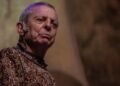 Hijo de César Bono desmiente que el actor haya perdido un ojo tras cirugía